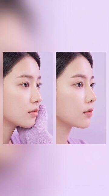 리뷰티 쇼츠 일러스트 — 코 라인 변화, 한 컷 비교
